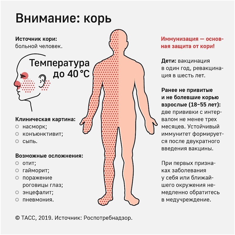 «Корь – старая новая инфекция».